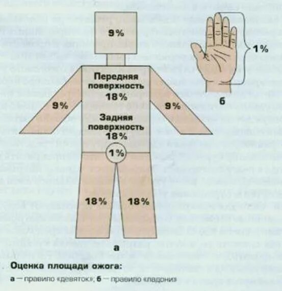 Площадь поражения при ожогах. Площадь ожога правило ладони. Правило девяток и ладони. Измерение площади ожога ладонью.