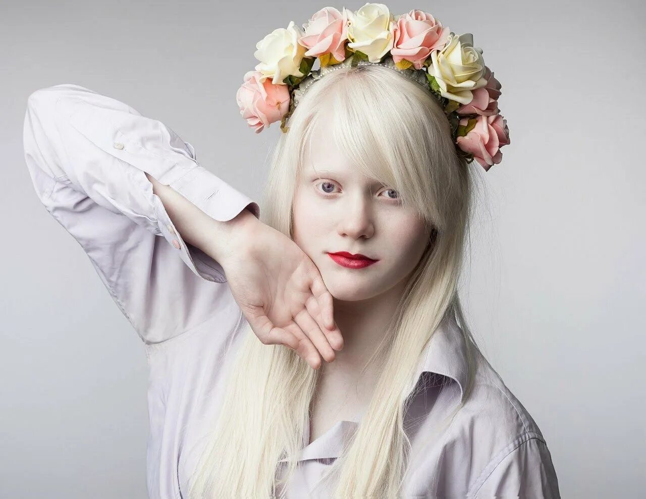 Катерина тимошенко альбинос. Белые люди как их называют. Катерина тимошенко альбинос. Белые люди как их называют. Альбиносы люди.