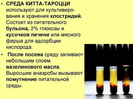 Среда китта тароцци