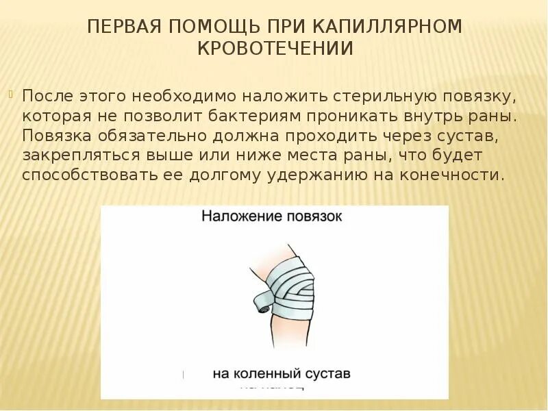 Наложение повязки при кровотечении. Повязка при капиллярном кровотечении. Капиллярное кровотечение первая помощь. Наложение давящей повязки при капиллярном кровотечении.