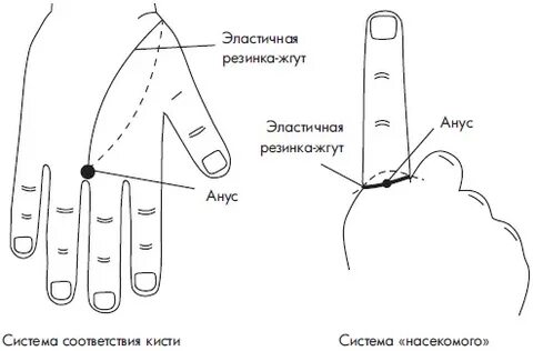 Жгут задний проход