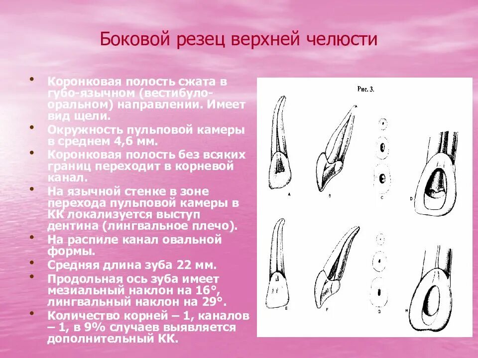 Зуб боковой резец. Латеральный резец верхней челюсти моделирование. Верхний Центральный резец анатомия. Верхний боковой резец анатомия. Резец верхней челюсти анатомия корневых каналов.