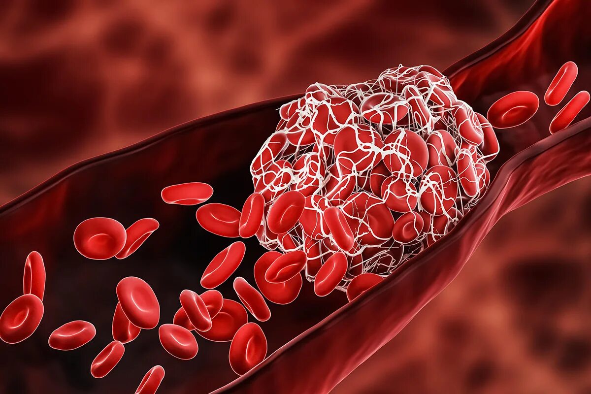 Тромбоциты. Кровеносные клетки. Тромбоциты в крови. Тромбоциты и тромбы