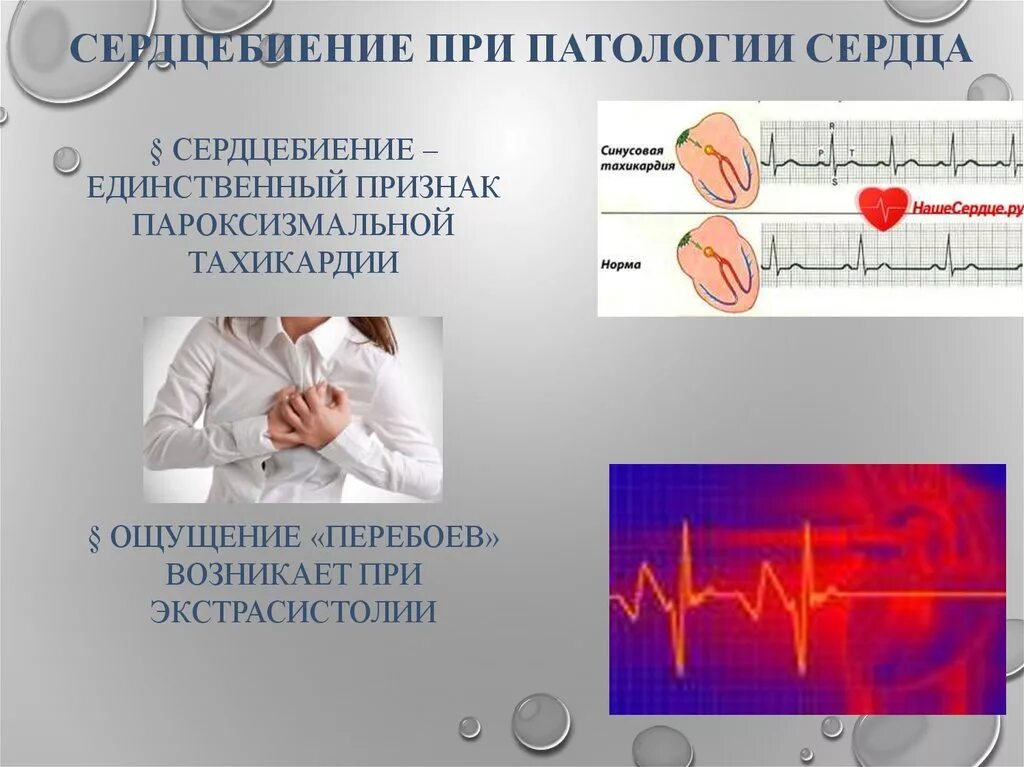 Сильно стучит сердце что делать. Ощущение сердцебиения. Чувствуется сердцебиение. Пульс сердца.