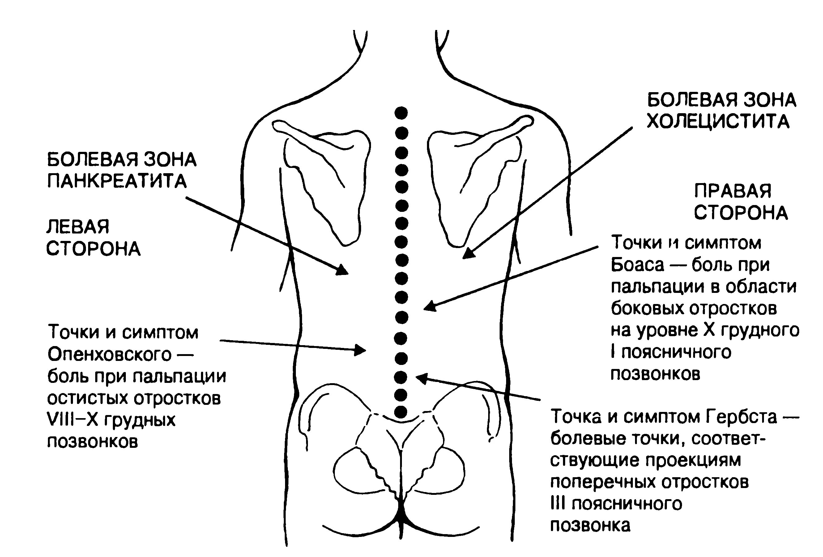 Болевые точки и зоны желчного пузыря. Болевые точки при заболеваниях кишечника. Болевые точки при заболеваниях желудка и 12-ти перстной. Болевые точки и зоны при хроническом холецистите. Боль справа внизу отдает в поясницу