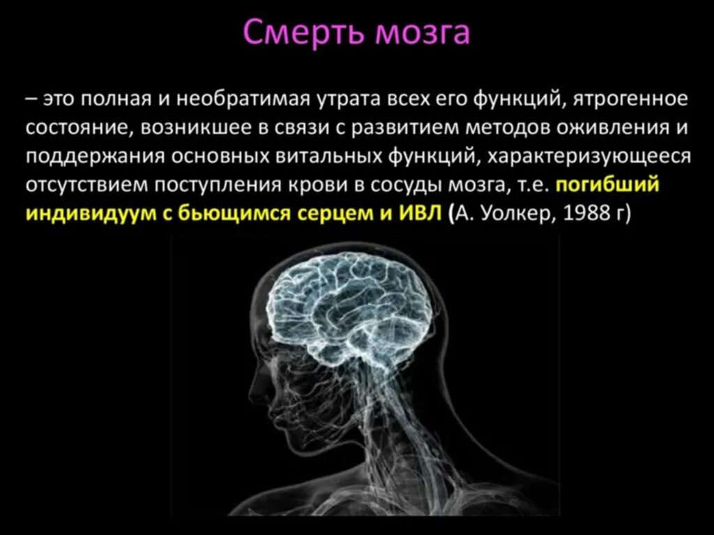 Мозги попал. Человеческий мозг после смерти.