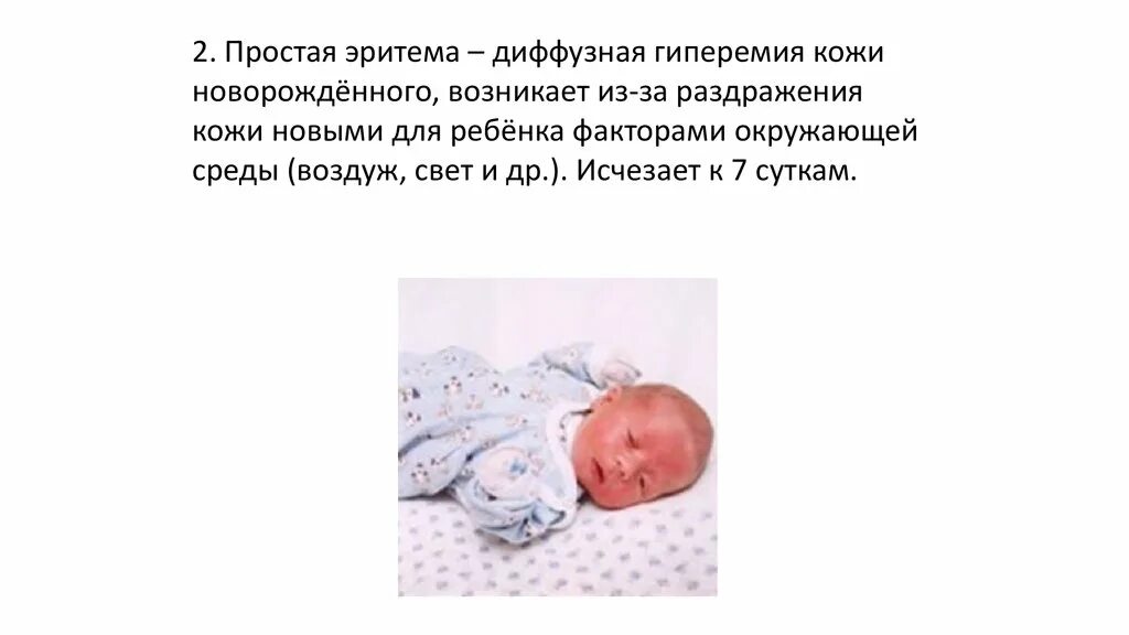 Пограничные состояния новорожденных токсическая эритема. Простая (физиологическая) эритема.. Физиологическая эритема новорожденного ребенка. Физиологические состояния новорожденных.