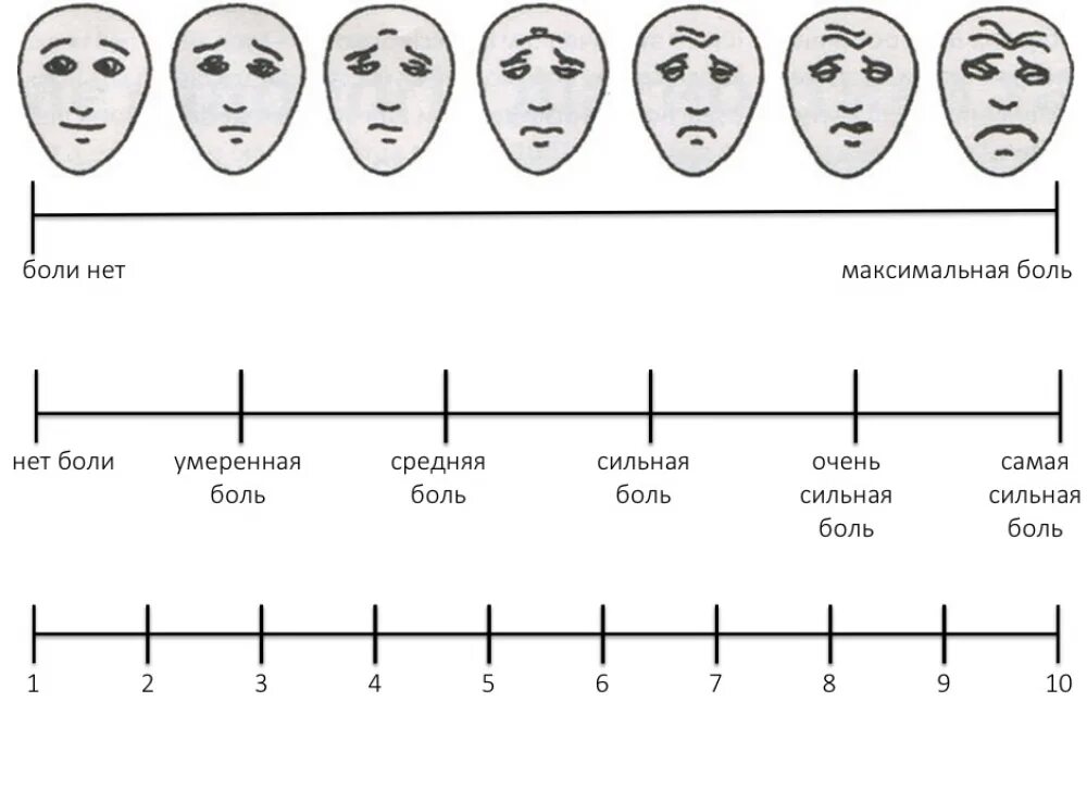 Насколько по шкале. Шкала боли. Визуально-аналоговая шкала боли. Шкала интенсивности боли. Шкала.