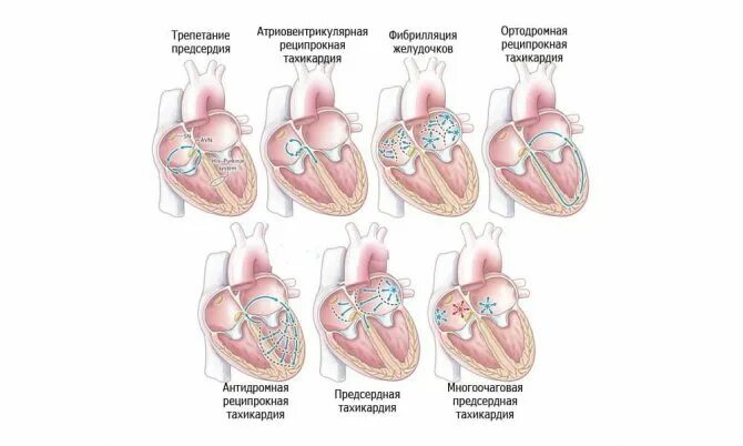 Сильно стучит сердце что делать. Почему сердце бьётся сильно. Сильно колотится сердце. Сердце быстро бьется в состоянии покоя.