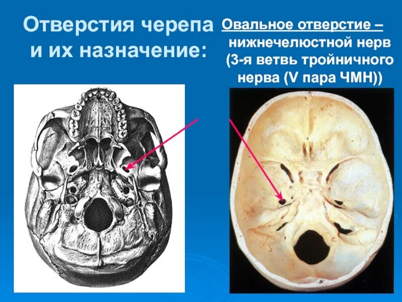 Остистое отверстие в полости черепа. Шилососцевидное отверстие нерв. Овальное отверстие черепа. Круглое отверстие черепа. В полости черепа расположен