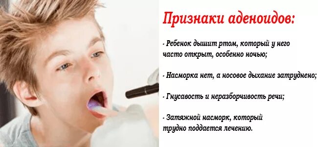 Аденоиды признаки. Симптомы разносшийся оденоида. Симптомы аденоидов у детей. Признаки аденойдов у ребёнка.