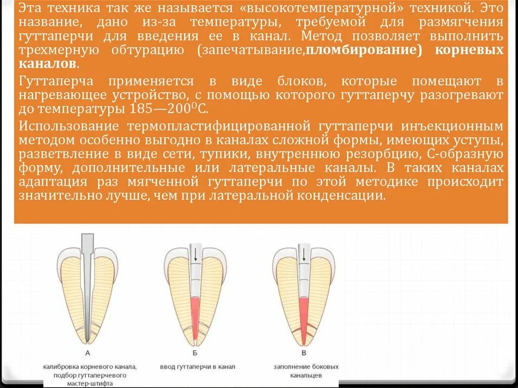 Протокол пломбирования корневых каналов гуттаперчей. Пломбирования корневых каналов метода Термофил. Метод латеральной конденсации для пломбирования корневых каналов. Методы пломбирования корневых каналов гуттаперчей.