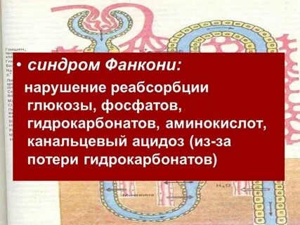 Синдром тони дебре фанкони