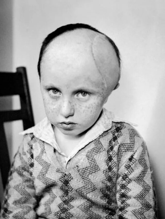 Человек больной шизофренией. Психически больные люди. Шизофрения фотосессия. Лица с психическими расстройствами. Люди с психическими расстройствами.