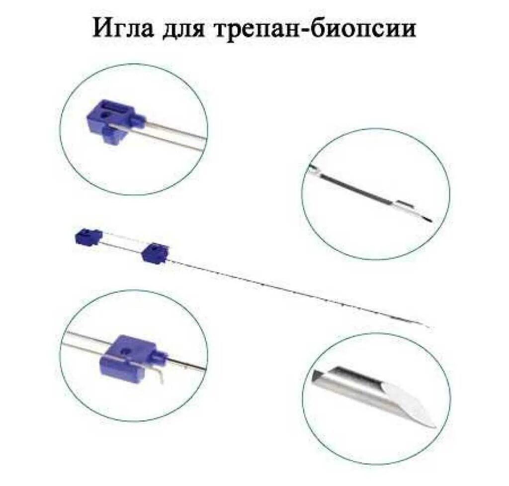 Трепанобиопсия молочной железы что это. Игла биопсийная 10g. Игла для трепан биопсии молочной. Размер иглы для биопсии молочной железы. Игла для трепан биопсии 16 g.