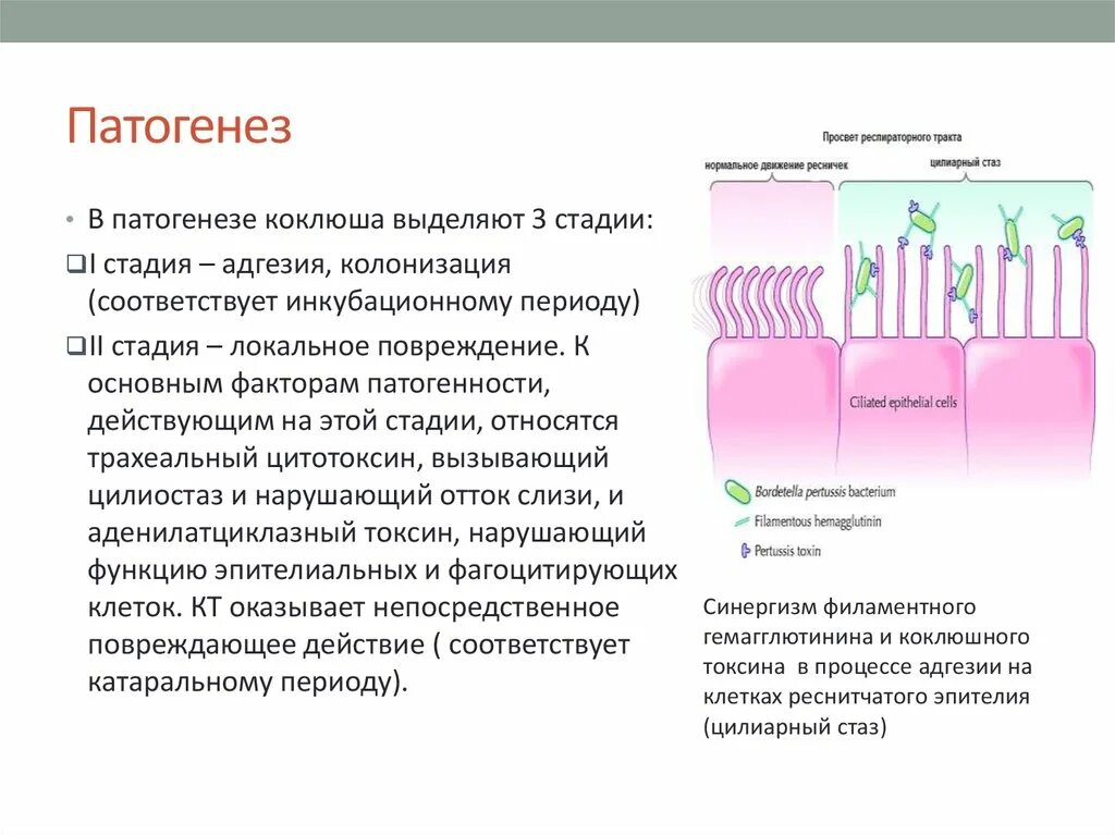 Чем отличается коклюш. Коклюш паракоклюш патогенез. Коклюш патогенез кратко. Коклюш этиология патанатомия. Патогенез коклюша схема.