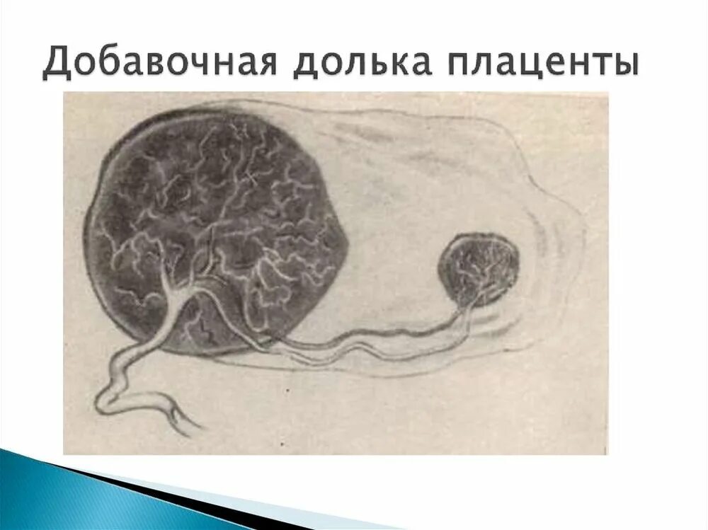 Патология последа
