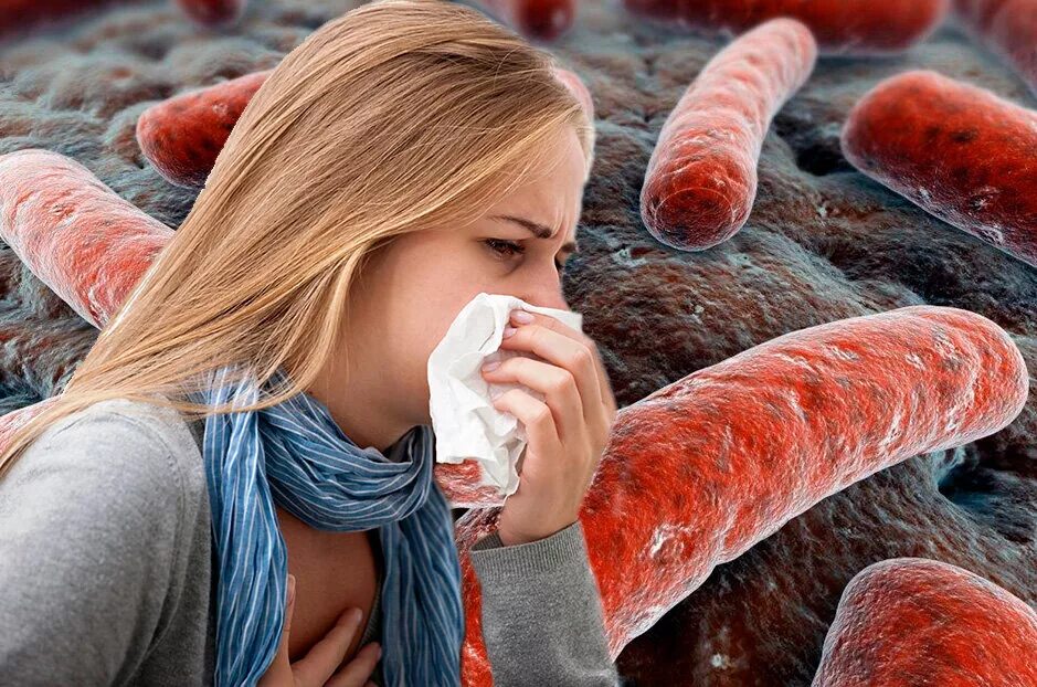 Туберкулез tuberculosis. Туберкулезная палочка палочка Коха. Палочка Коха туберкулез.