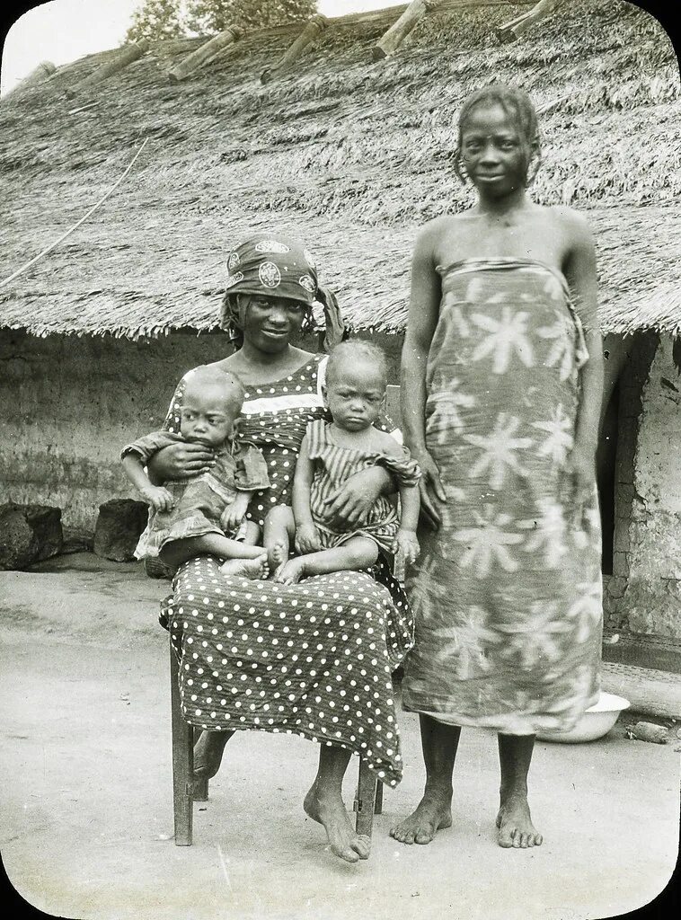 Бельгийское Конго дети. Зверства бельгийцев в Конго. Бельгийское Конго отрубленные руки.