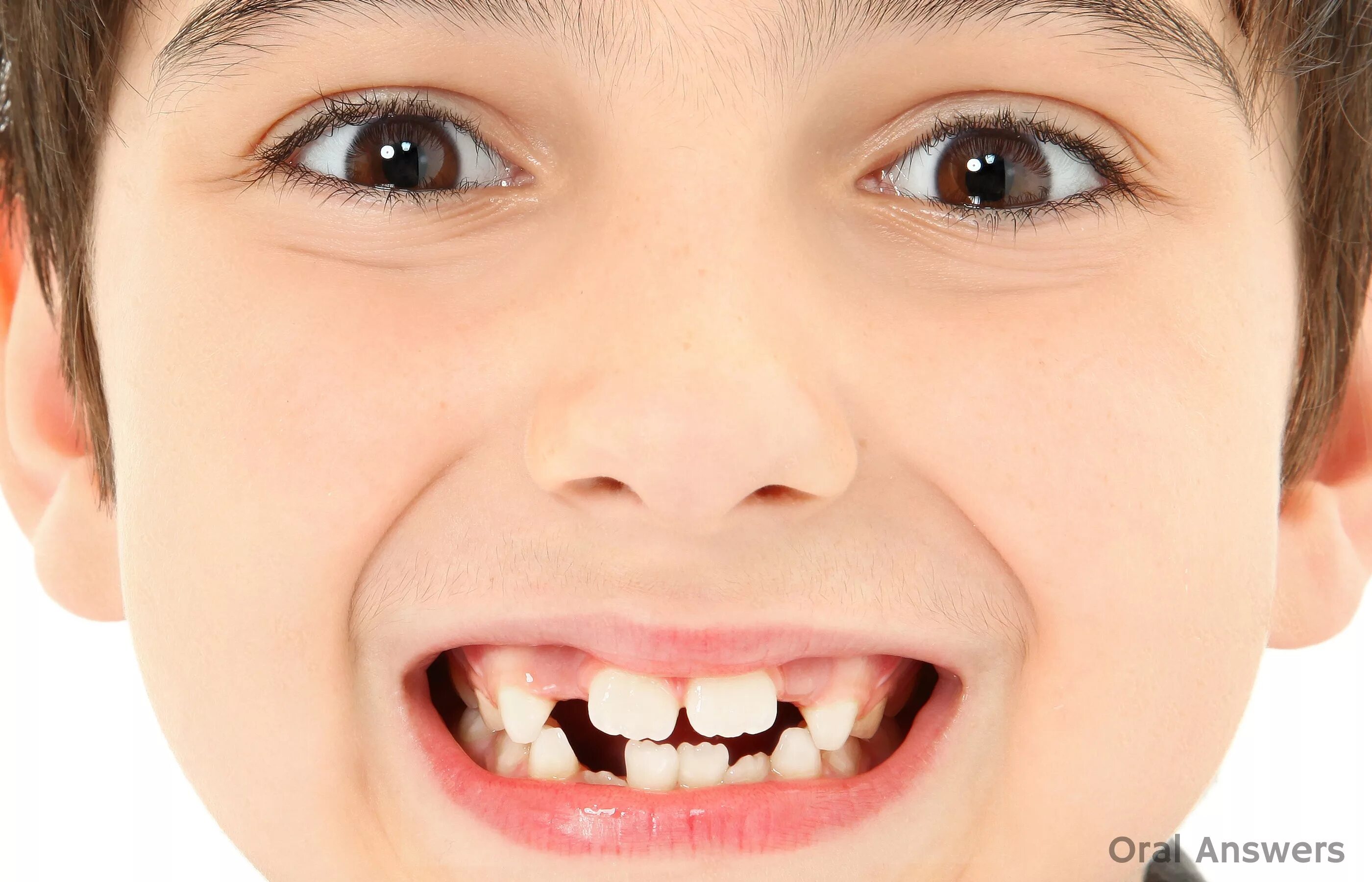 Ребенок год скрежет зубами. Коренные зубы у детей.