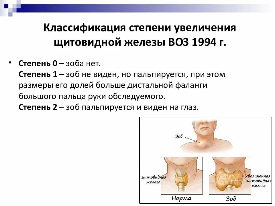 Щитовидная железа классификация. Степени увеличения щитовидной железы воз 1994. Классификация воз щитовидная железа. Стадии узлового зоба щитовидной железы. Зоб щитовидной железы классификация 1 степени.