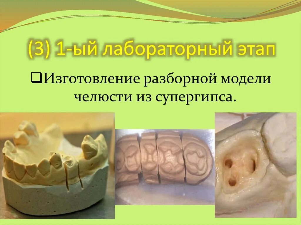 3 вкладки. Этапы изготовления разборной модели. изготовление разборной вкладки. разборная модель из супергипса. этапы изготовления металлической вкладки.