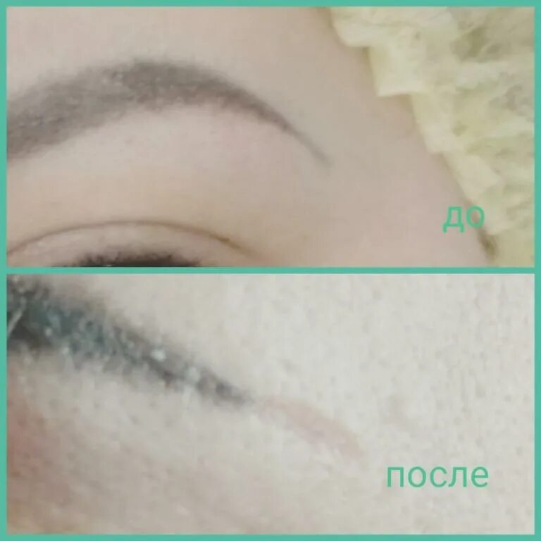 ремувер для снятия татуажа бровей