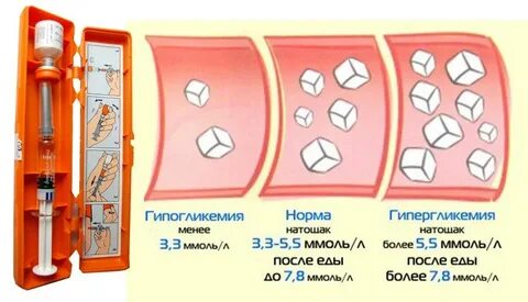 Гипогликемия и гипергликемия
