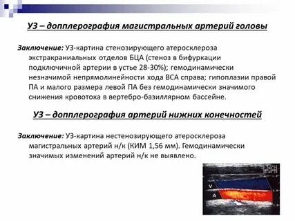 Что такое нестенозирующий атеросклероз артерий нижних конечностей