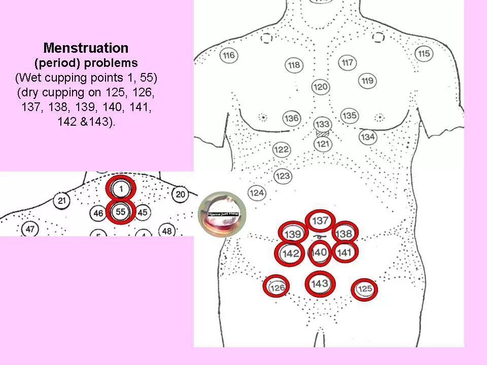 Банки на печень. Точки хиджама атлас точек. Хиджама атлас точек для женщин. Схема хиджама точки.