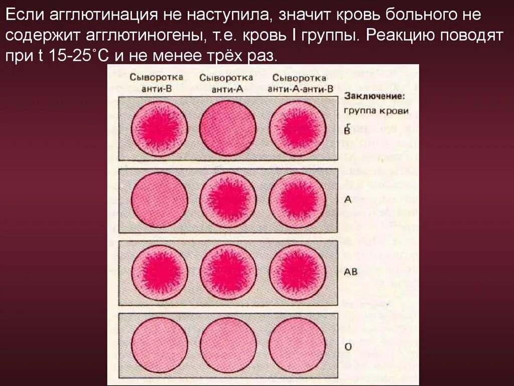 Кровь розовая почему. Реакция агглютинации группы крови. Реакция агглютинации для определения группы крови. При 1 группе крови агглютинация происходит. Агглютинация эритроцитов группа крови.