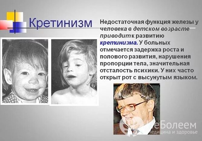 критинизм это