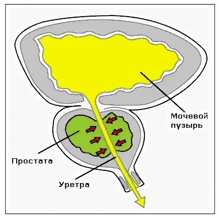 Схема простаты. Простата. Мочевой пузырь. Мочевой пузырь уретра простата.