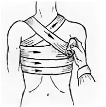 Техника наложения повязок на грудную клетку. Восьмиобразная повязка на грудь. Бинтовая повязка на молочную железу. Крестообразная повязка на грудную клетку. Спиральная на грудь бинтовая повязка.