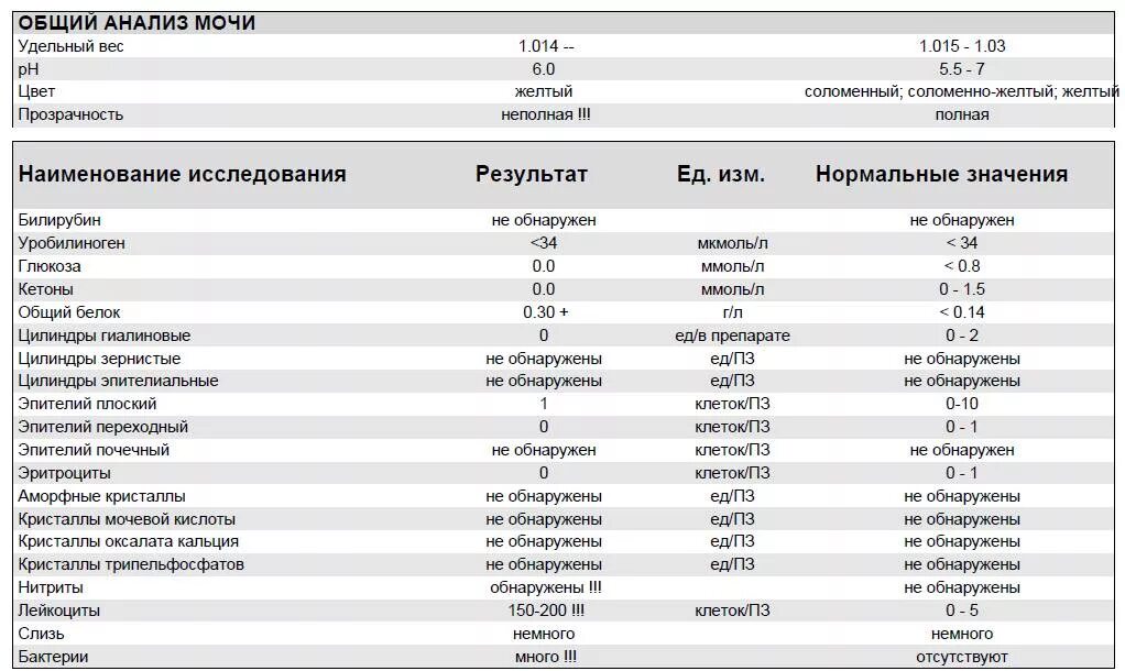 Эпителий какая норма. Цистит ОАМ показатели. Исследование мочи эпителий норма. Эпителий плоский мочи норма. Анализ мочи прозрачность.