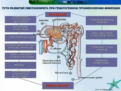 Пути пиелонефрита