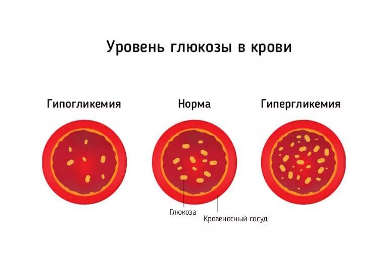 Большое количество глюкозы в крови