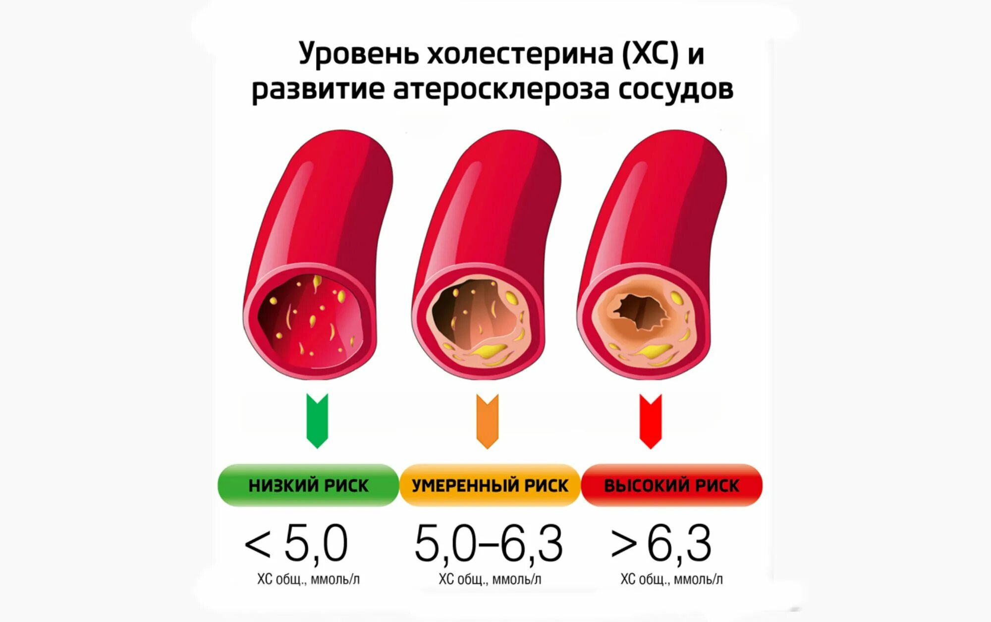 О чем говорит повышенный холестерин в крови. Уровень холестерина. Priznaki visokova xolesterina. Симптомы высокого холестерина. Симптомы высокого холестерина в крови.