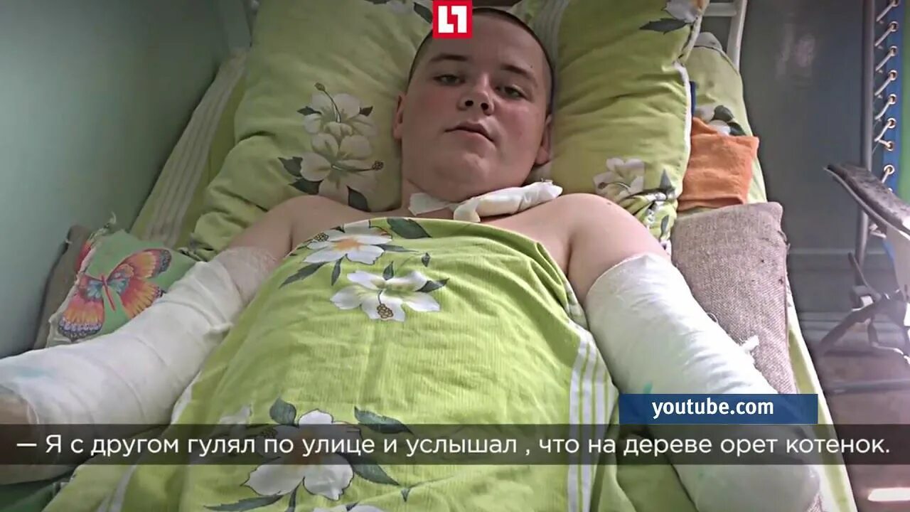 Лишилась обеих рук. Девушка с ампутированными руками. Девушка с ампутированной рукой. Лишилась обеих рук. Четырехлетний ребенок.