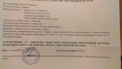 Диагноз диффузная щитовидная железа