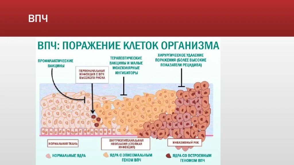 Вирус папилломы человека (ВПЧ). Вируспопиломы человека.