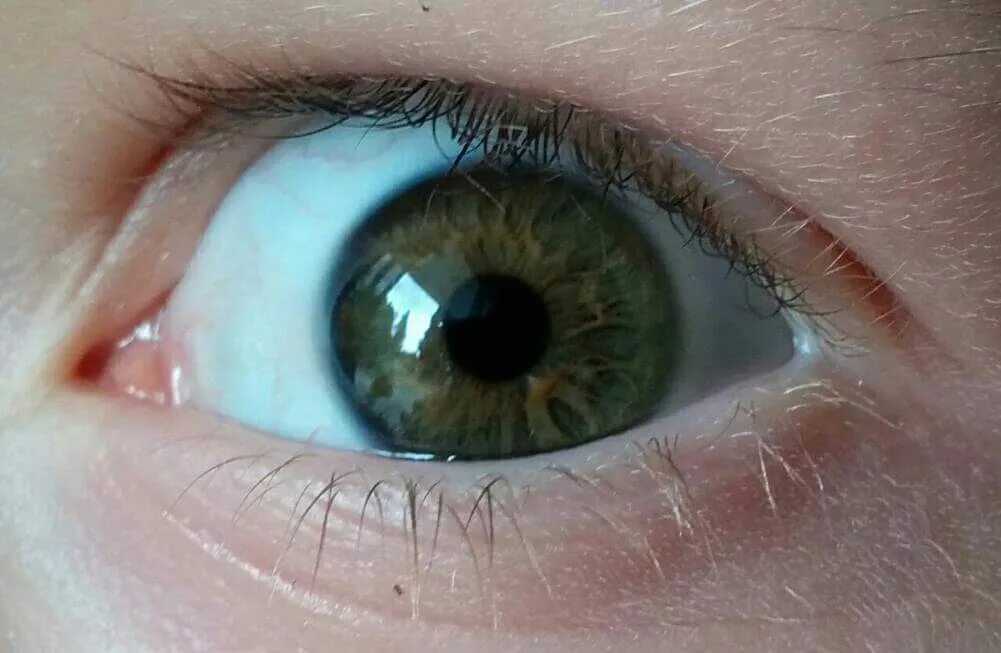 Центральная гетерохромия хамелеон. Зеленый цвет глаз. Серо зеленые глаза радужка. Серо-карие глаза у ребенка.