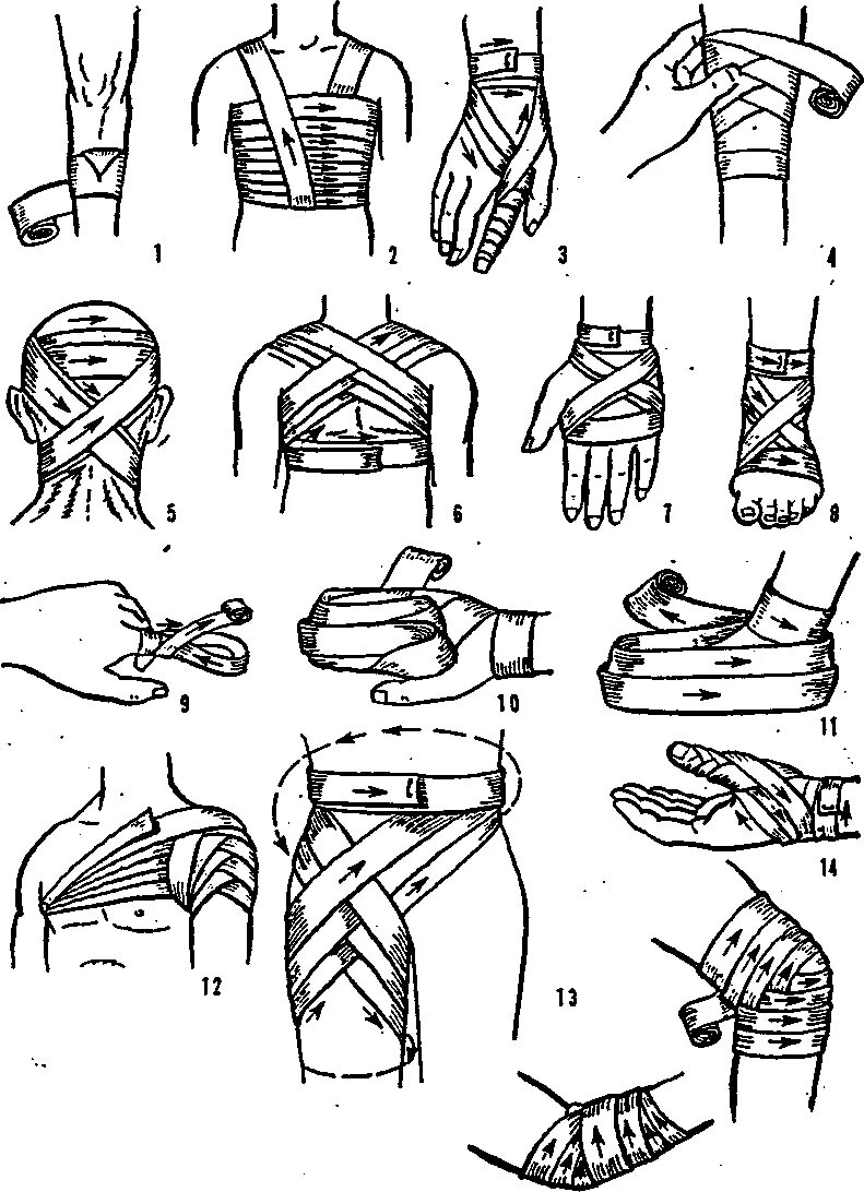 Повязка на руку схема. Десмургия повязки алгоритм. Десмургия техника наложения повязок. Десмургия бинтовые повязки. Повязки на туловище десмургия.