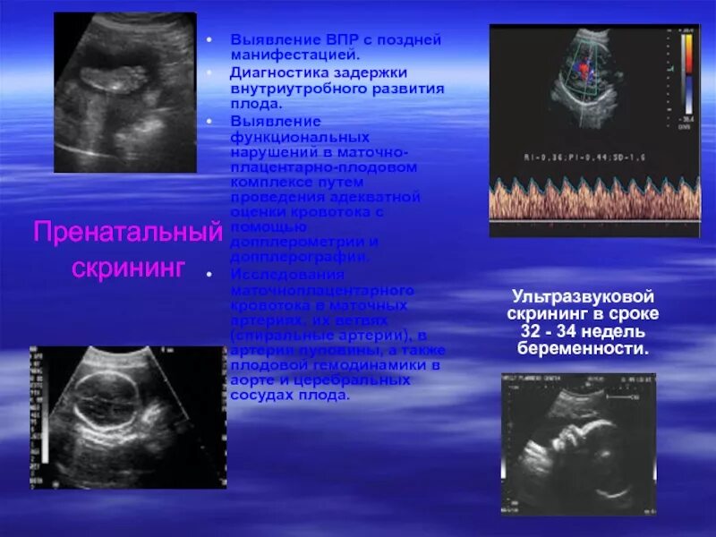 Скрининг впс