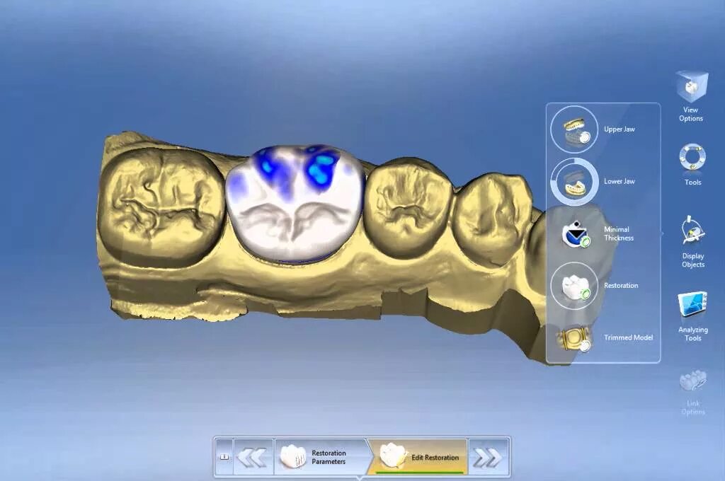Cad cam моделирование. Cad cam сканирование. cad cam системы в стоматологии. технология cerec.