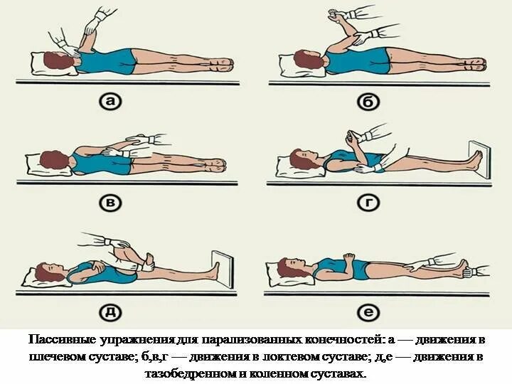 Упражнения при параличе конечностей после инсульта. Методика массажа при ОНМК реабилитация. ЛФК после инсульта гемипарез. Лечебная физкультура при остром нарушении мозгового кровообращения.