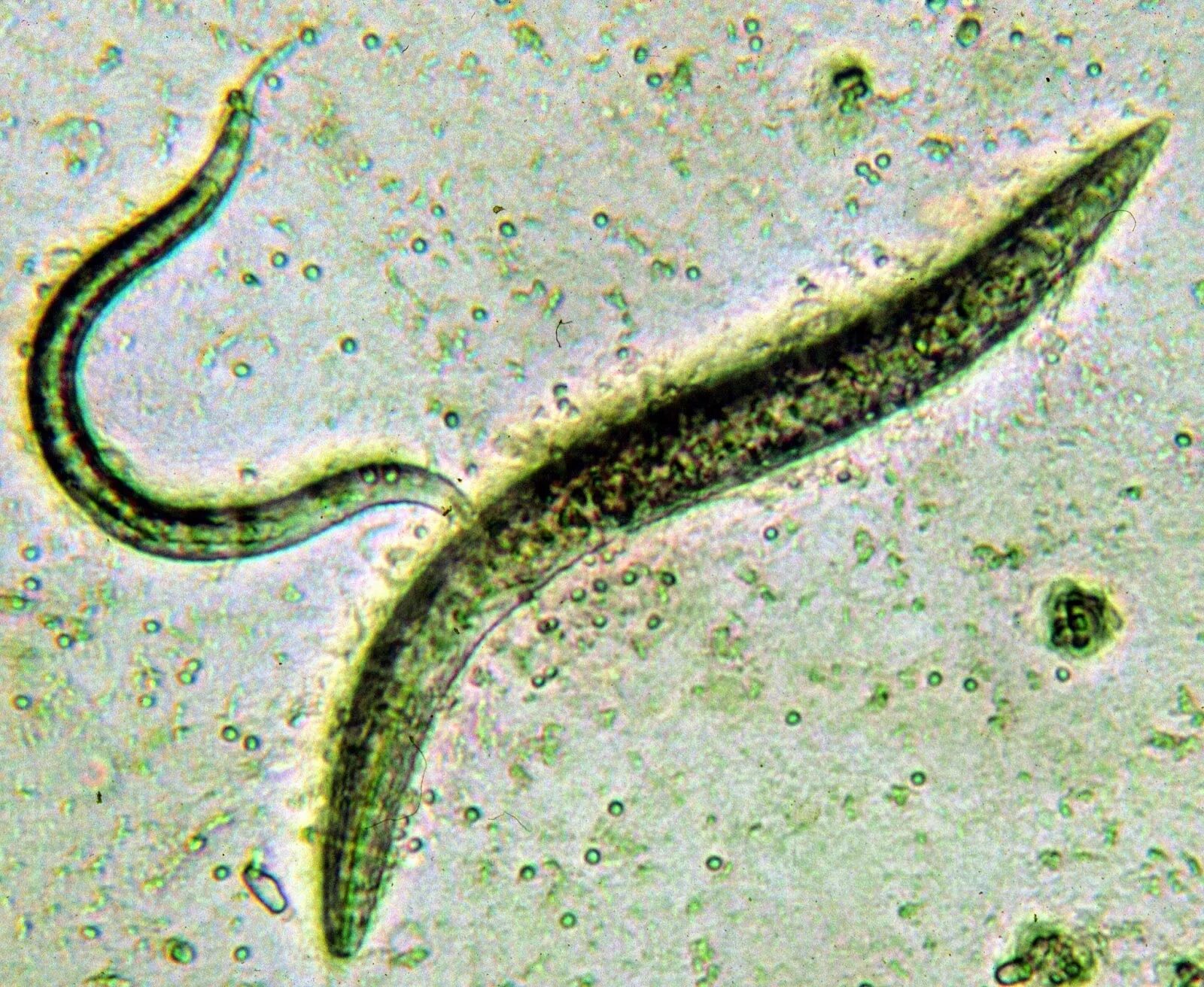 Nematoda (круглые черви). Круглые черви (нематоды) микроскоп.