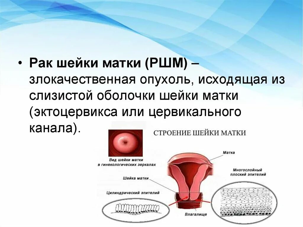 Эндоцервикс цилиндрический. Экзоцервикс и эндоцервикс что это. Слизистая оболочка шейки матки.