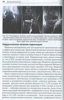 Варикоцеле у подростков 14