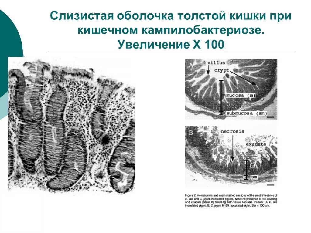 Слизистая оболочка 12 кишки. Кампилобактерии патогенез. Кампилобактериоз патогенез. Эпидемиология кампилобактерий. Слизистая оболочка толстой кишки.